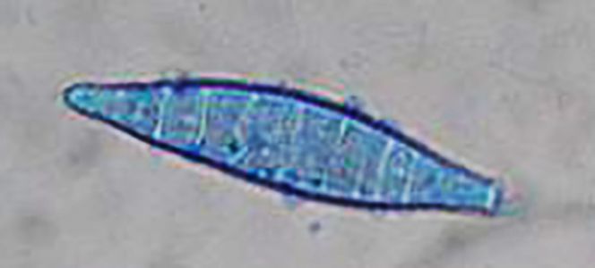 Microsporum canis
